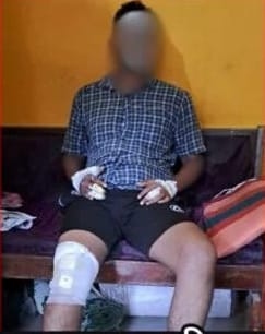 https://kokansadlive.com/uploads/article/sml_14228_pic_20241003.1534.jpg