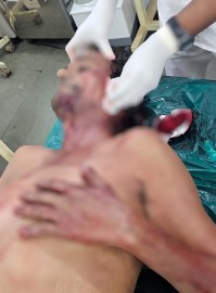 https://kokansadlive.com/uploads/article/sml_21820_pic_20250813.1940.jpeg